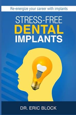 The Stress-Free Dental Implants