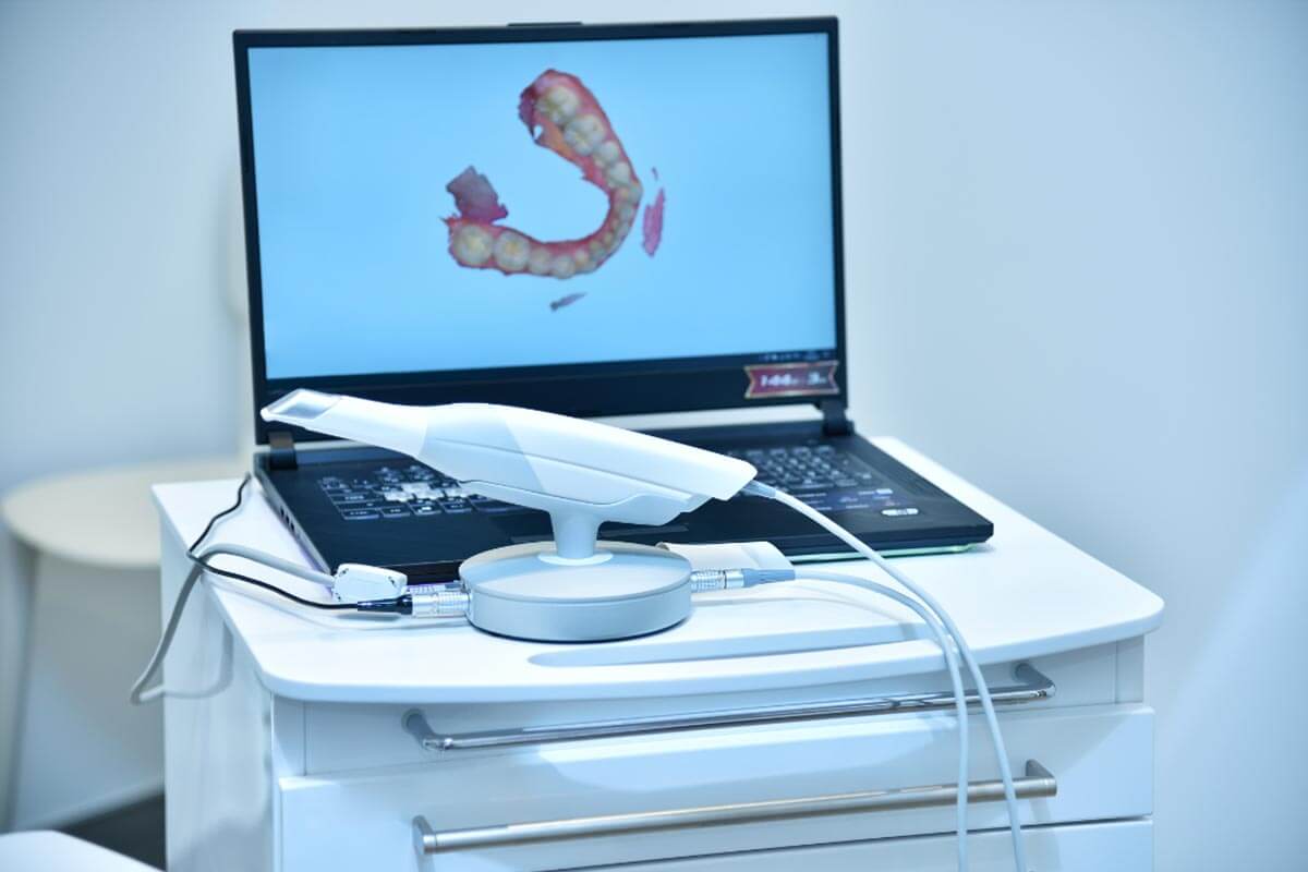 Overcome Burnout by Adding Impression-Less Intraoral Digital Scanners To Your Practice